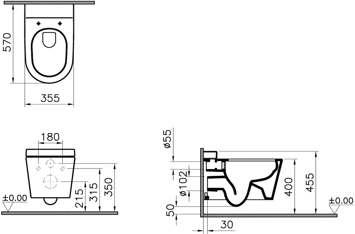 Унитаз подвесной VitrA Nest 5176B003-6233 безободковый, с микролифтом, с функцией биде и встроенным смесителем